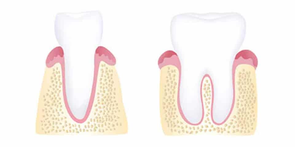 Healthy Gums Photo